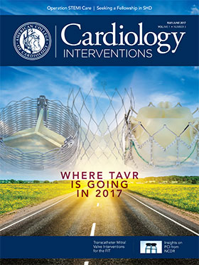 Cardiology Interventions